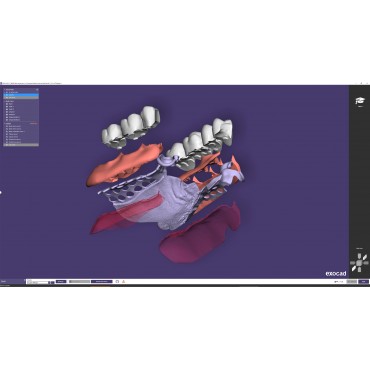 Dental CAD - EXOCAD