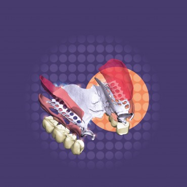 Dental CAD - EXOCAD