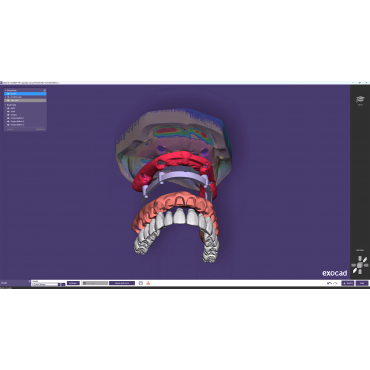Dental CAD - EXOCAD