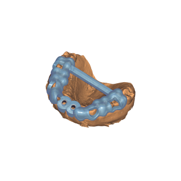 EXOPLAN