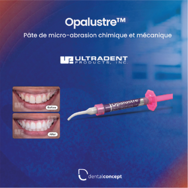 Opalustre™